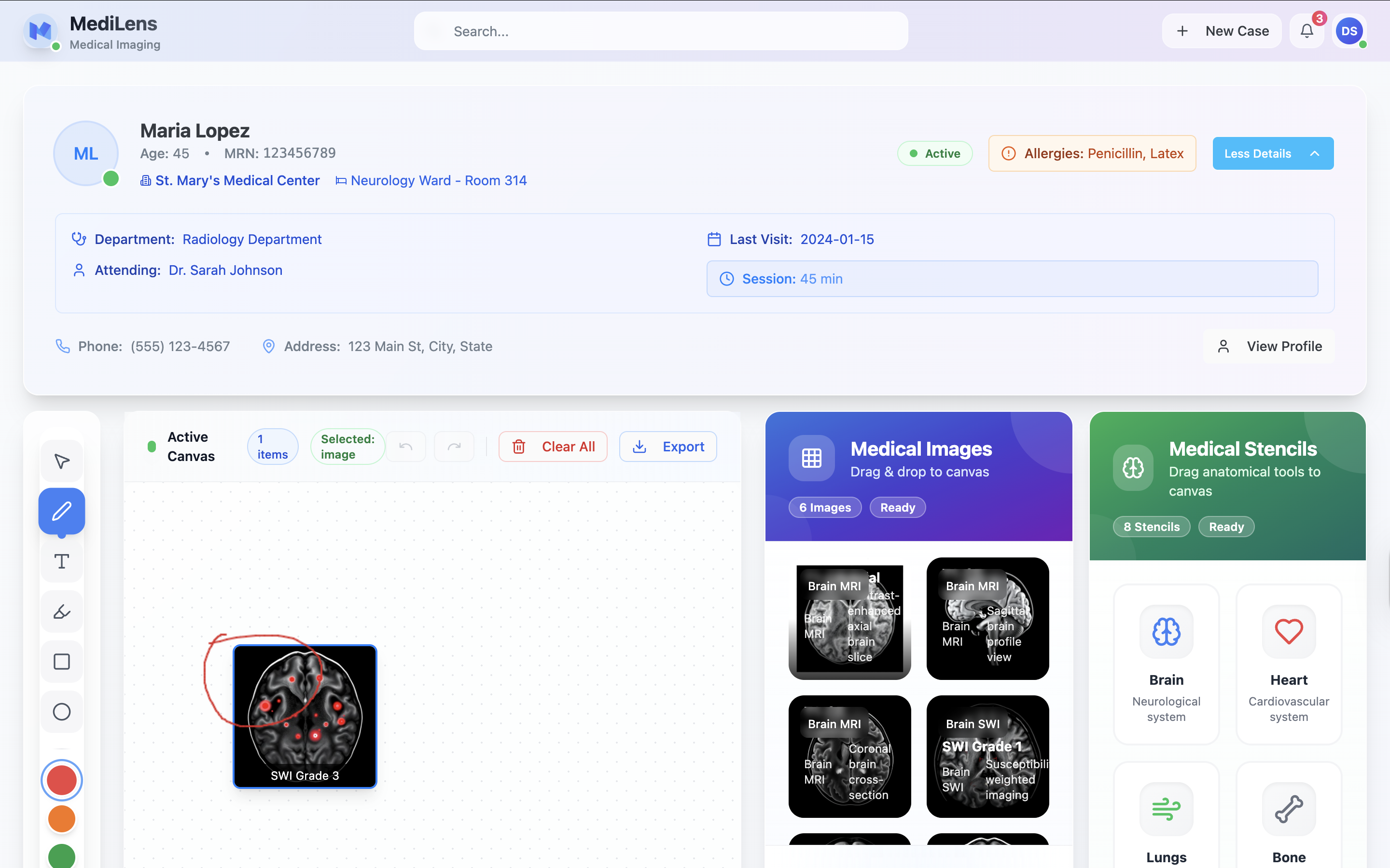 MediLens main interface showing patient information for Maria Lopez with brain MRI scans and annotation tools