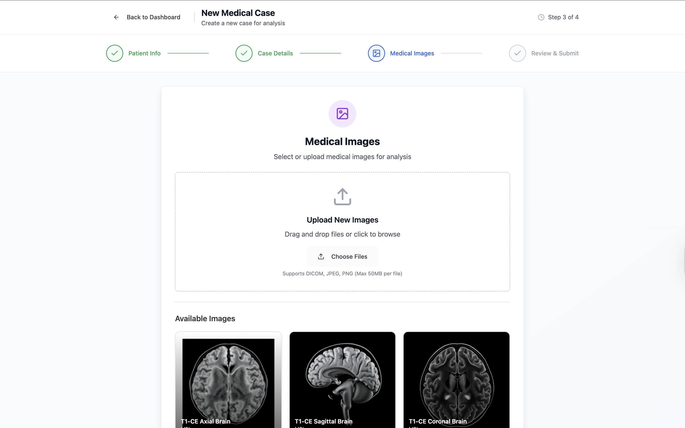 MediLens medical images upload interface with available brain scan images including T1-CE Axial, Sagittal, and Coronal Brain scans